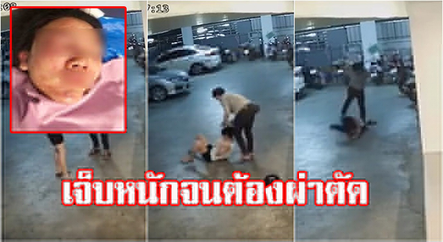 เจ็บหนัก