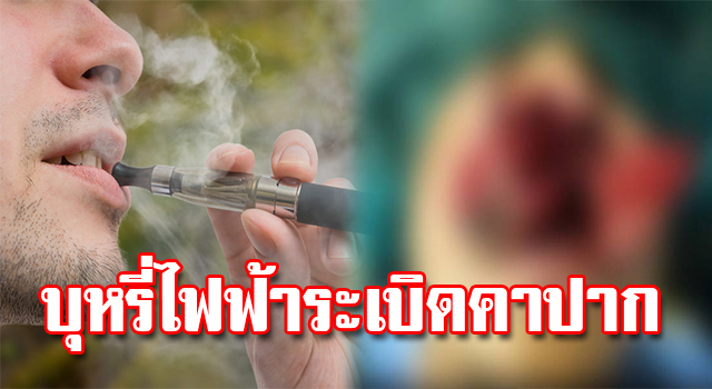 บุหรี่ไฟฟ้า
