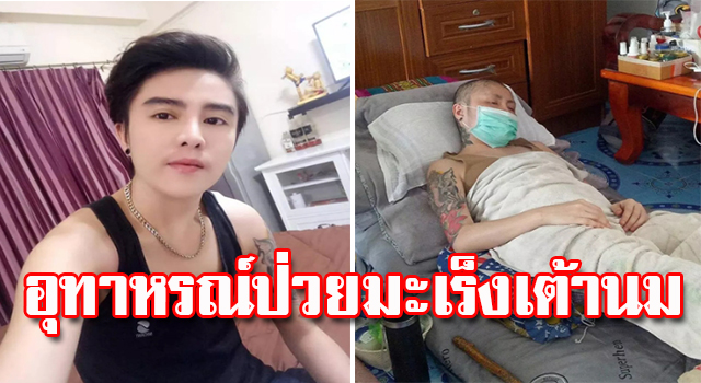 มะเร็งเต้านม