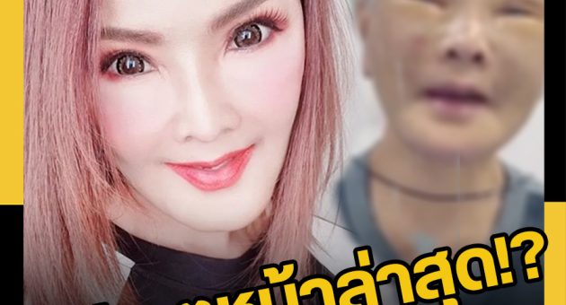 ข่าว